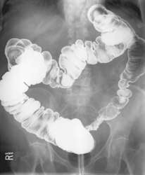 Illustration for article titled TMI Tuesday: My superhero name will be Megacolon